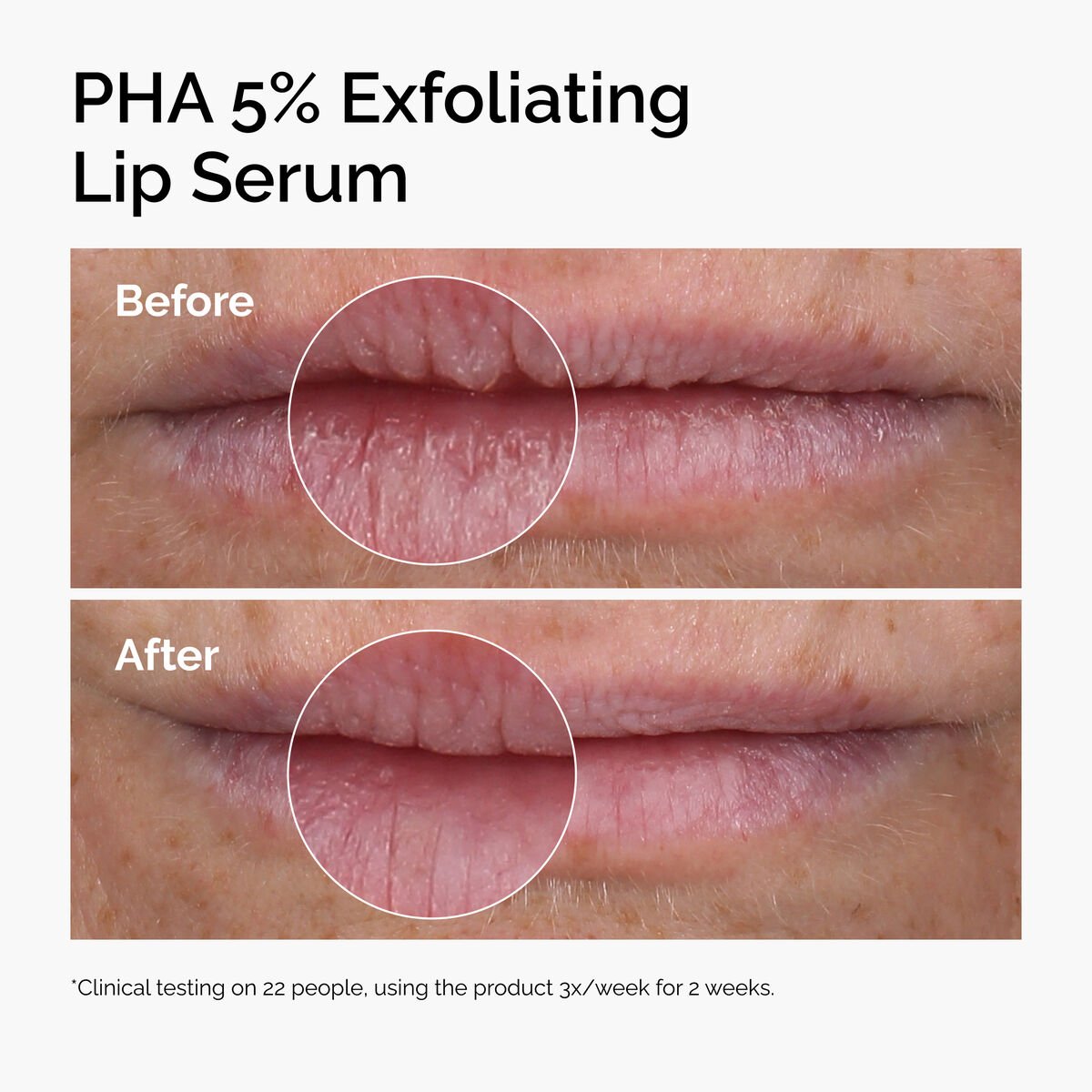 the ordinary pha 5% exfoliating lip serum the ordinary pha 5% exfoliating lip serum